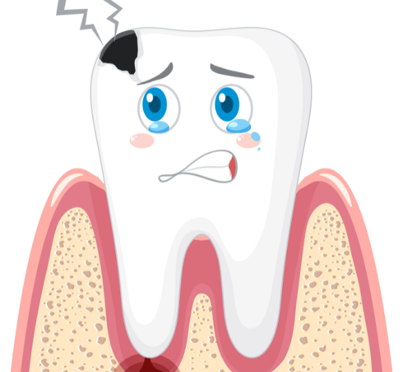 tooth decay pain