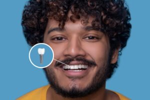 best dental implant clinic
