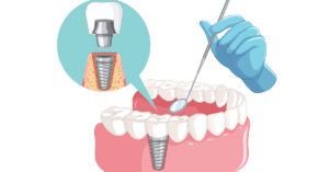 Dental Clinic in Virar