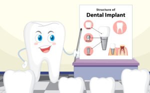best dental implant clinic in Virar