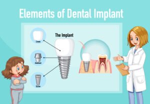 best dental implant clinic in Virar