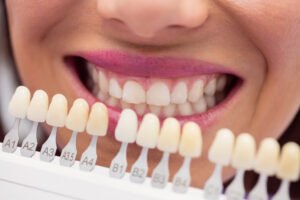 teeth whitening in Virar