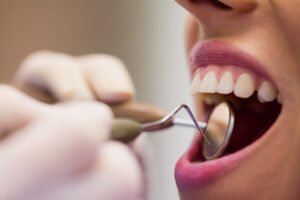 dental services
